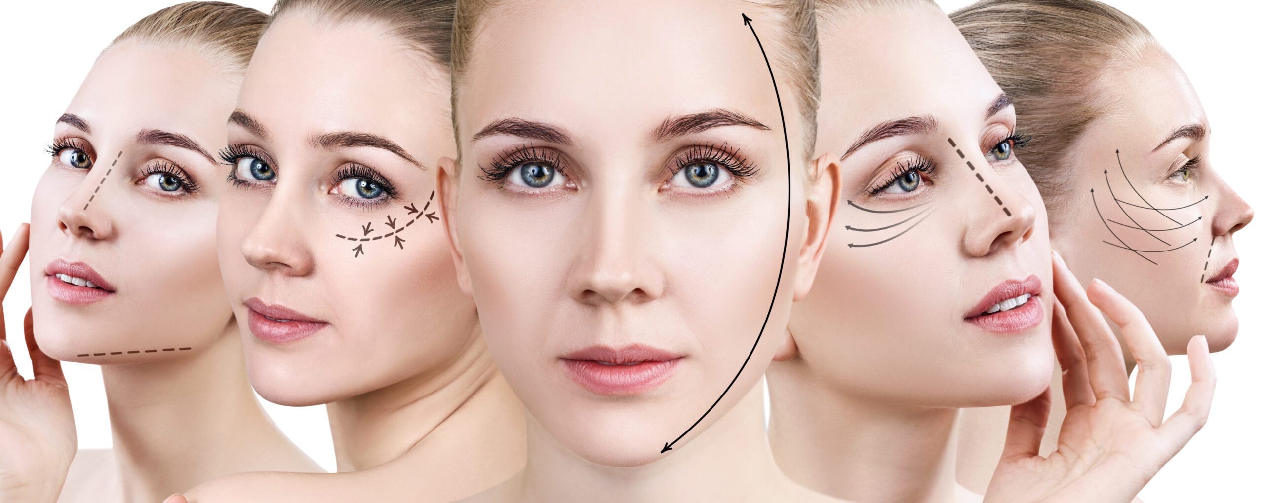 Facelifting Behandlung 