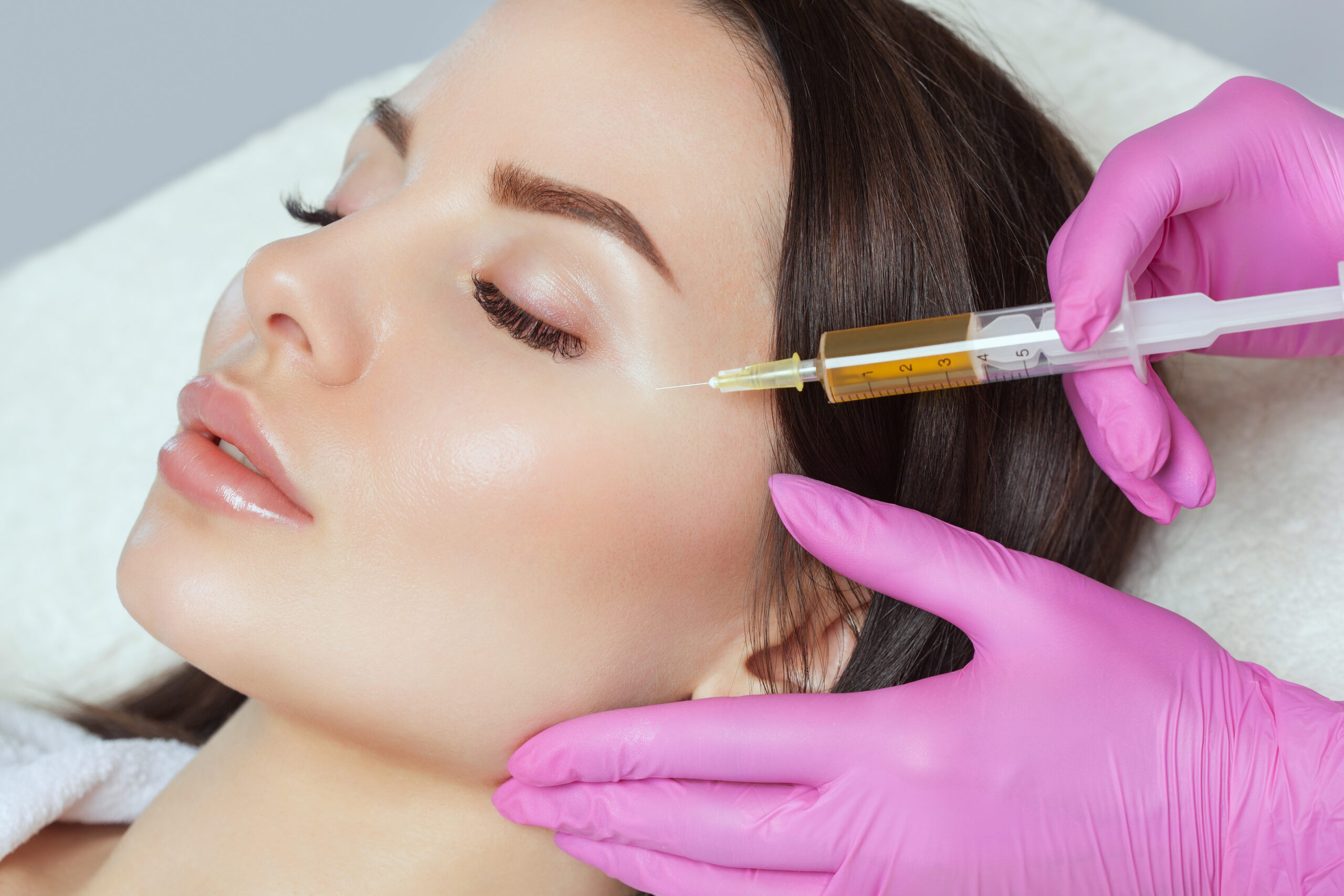 Mesotherapie PRP Behandlung